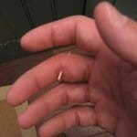 splinter in hand first aid for splinters